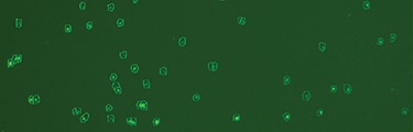 Fluorescent Protein Reporter Gene Transduction Efficiency Measured with the Countess II FL Automated Cell Counter